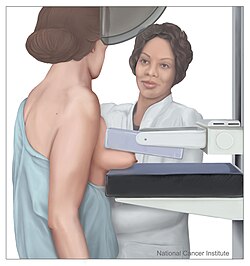 Cartoon of a mammogram, with the breast to be imaged pressed between two plates