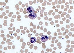 Four neutrophils in a Giemsa-stained blood film