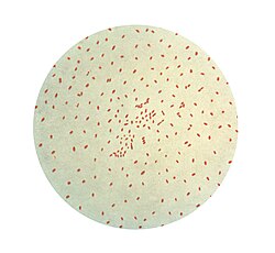 Gram stain of Bordetella pertussis