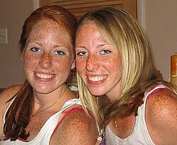 Women with freckles