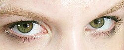 Mixed Brown-Green, or Hazel-Green, eyes