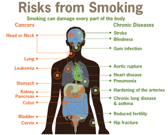 A diagram depicting the risks to health caused by smoking tobacco, most often cigarettes