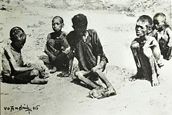 Severely malnourished children in Vietnamese famine of 1944–1945