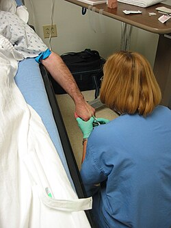 A nurse inserting an 18-gauge IV needle with cannula