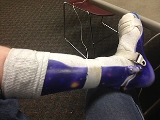 Ankle foot orthosis