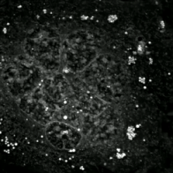 Long-term live cell imaging (12h) of multinucleated mouse pre-Adipocyte trying to undergo mitosis. Due to the excess of genetic material the cell fails to replicate and dies by apoptosis.