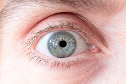 Gray eye