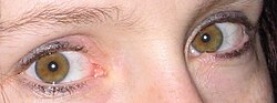 Golden, or amber colored eyes. The iris is the color of a hazelnut shell. This is what hazel eyes traditionally refer to.