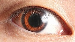 A light brown iris with limbal ring