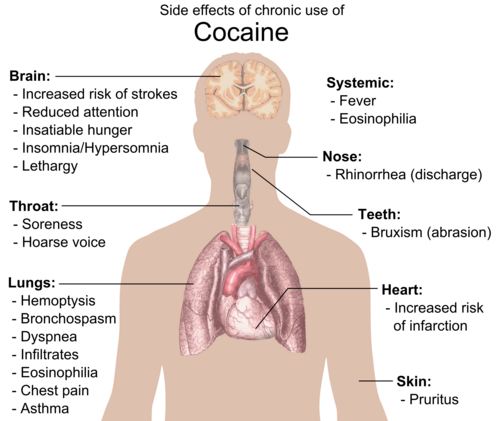 Side effects of chronic cocaine use