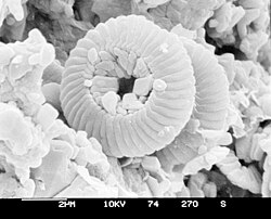Electron micrograph of microfossils from a sediment core obtained by the Deep Sea Drilling Program