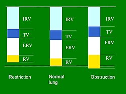 Scheme of changes in lung volumes in restricted and obstructed lung in comparison with healthy lung.