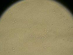 Film yeast like Candida (pictured) and Pichia can cover the surface of a wine with a film layer that not only consumed most of the free sulfur dioxide available to protect the wine but also produces high levels of acetic acid that will contribute to volatile acidity in a wine.