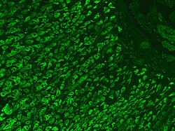 Immunofluorescence staining pattern of gastric parietal cell antibodies on a stomach section