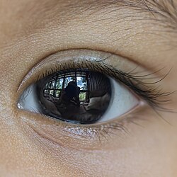 A dark brown iris bordering on black