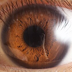 Light brown iris with a dark limbal ring