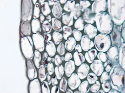 Cross section of collenchyma cells