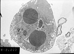 Neonatal cardiomyocytes ultrastructure after anoxia-reoxygenation
