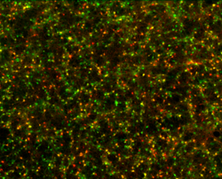 Rat nerve cells express red and green fluorescent proteins after viral transduction with two artificial adeno-associated viruses.